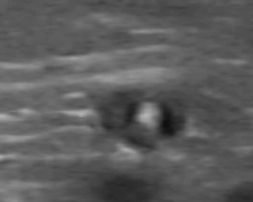 iv-ultrasound-3.jpg.244a36b757418c6400c22413c9ef8e0a.jpg