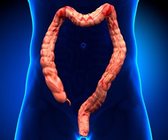 Diseases Of The Colon A Case For Getting A Colonoscopy General Nursing Allnurses
