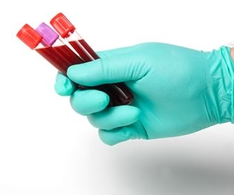 Blood Collection Variables are a Risk to Patients - General Nursing ...