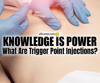 What You Need to Know About Trigger Point Injections