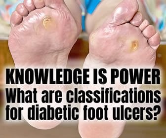 Classification Systems in Diabetic Foot Ulcers | Knowledge is Power