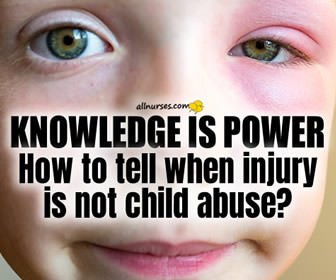 3 Injuries That Look Like Child Abuse But Are Not | Knowledge is Power