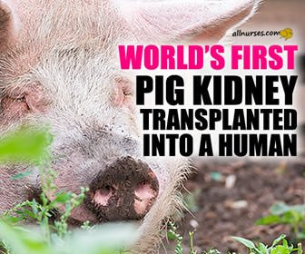 UAB Announces Xenotransplantation Breakthrough - Nursing News - allnurses