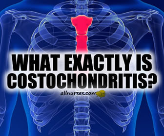 How is costochondritis treated?