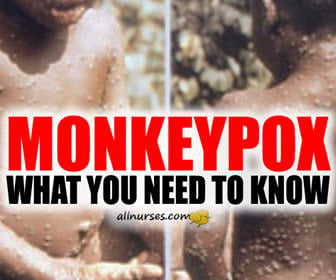 MONKEYPOX IS GOING VIRAL:  What You Need To Know!