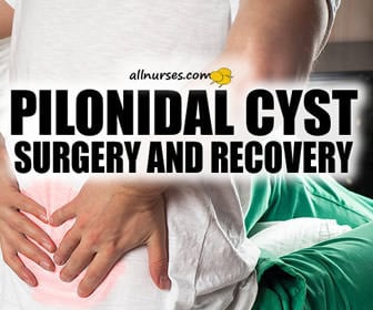 Three Points to Ponder with Pilonidal Sinus Surgery