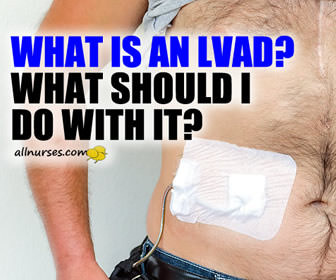What is a Left Ventricular Assist Device (LVAD)? | Knowledge is Power